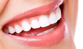 Sbiancamento denti al Laser